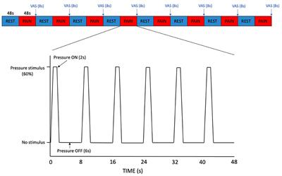 Imaging Brain Glx Dynamics in Response to Pressure Pain Stimulation: A 1H-fMRS Study